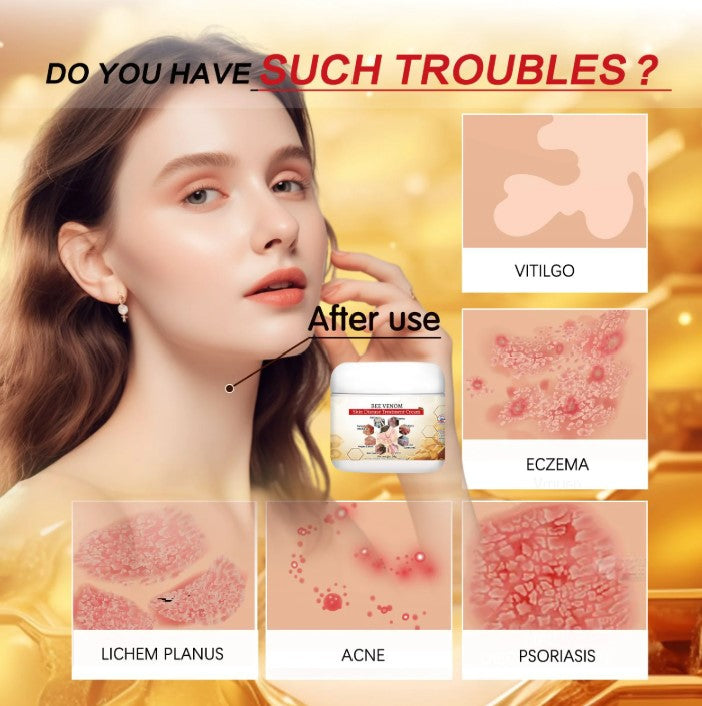 Bee Venom Soothing Cream