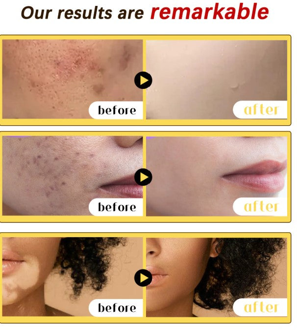 Bee Venom Soothing Cream