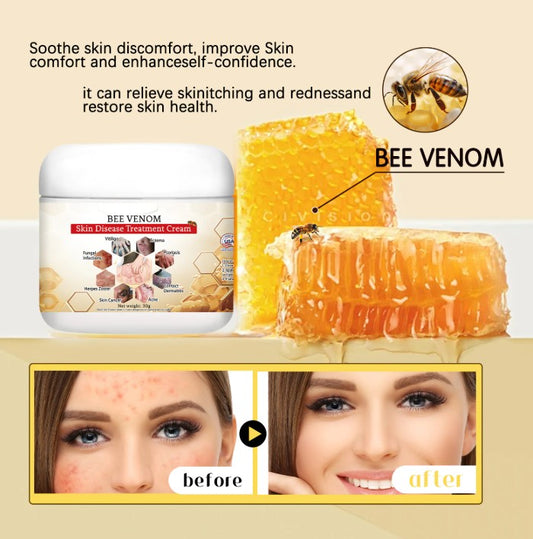 Bee Venom Soothing Cream