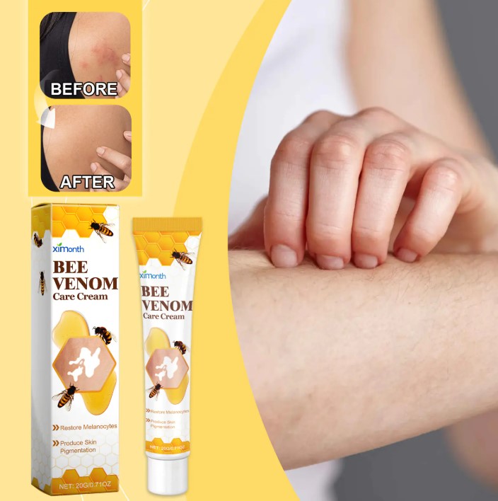 Bee White Spot Neck Cream - Natural Skin Repair for Neck Discoloration | Reduce White Spots & Even Skin Tone with Bee Venom